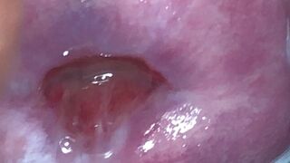 fertile cervix